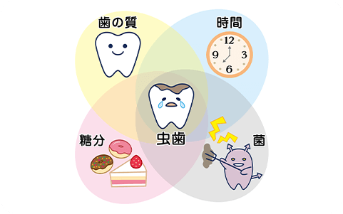 むし歯の原因