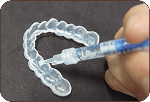 ホワイトニング剤を注入